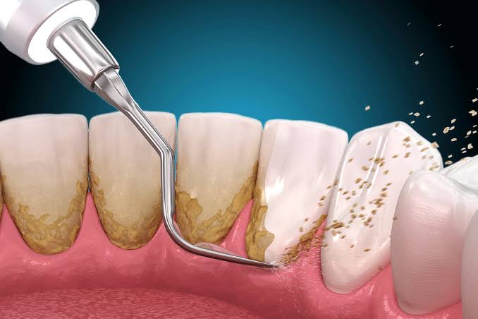 Tratamiento dental profesional en Odontología Integral